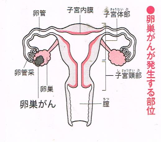 卵巣癌が発生する部位