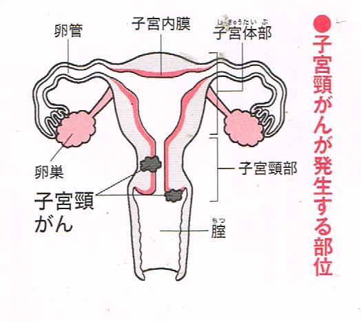 子宮頸癌を発生する部位